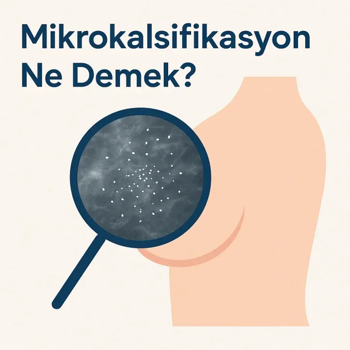 Mikrokalsifikasyon Ne Demek?