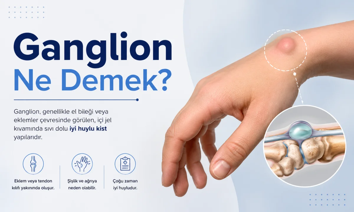 Ganglion Ne Demek?