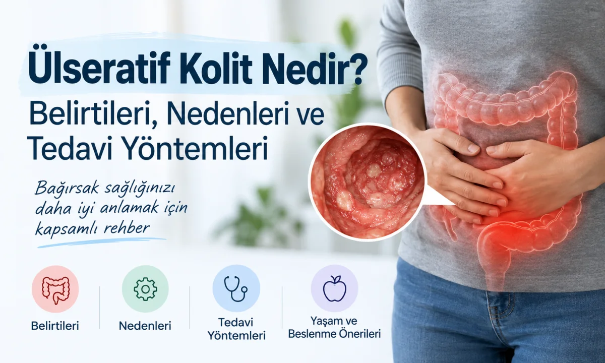 Ülseratif Kolit Nedir? Belirtileri, Nedenleri ve Tedavi Yöntemleri